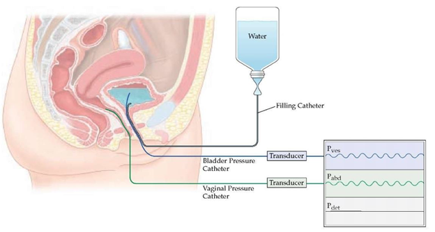 Compact bladder scanners for easy transport | Santron Meditronic