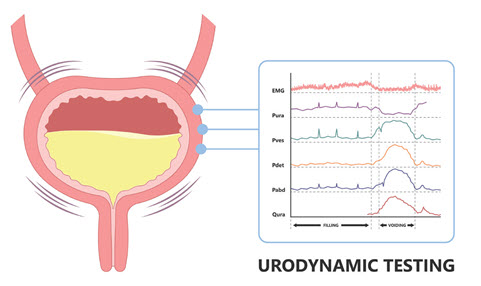 Understanding Urodynamic Testing