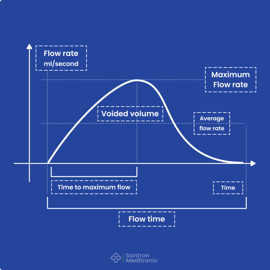 Understanding Uroflow Test Results