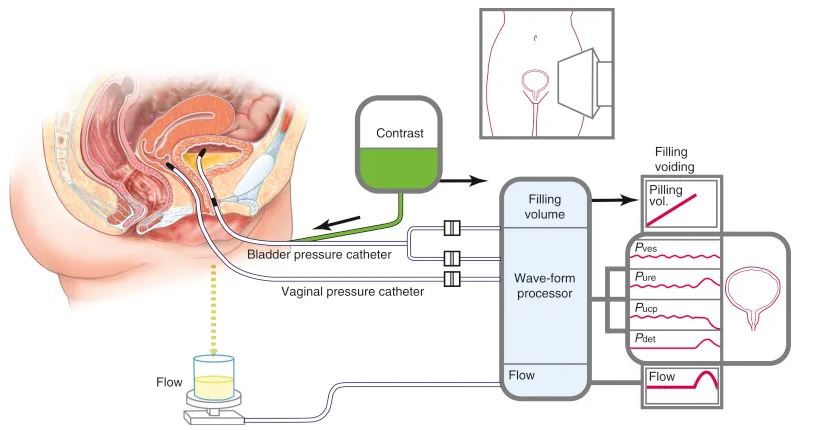 Urodynamic Testing Procedure: What Parents Should Know