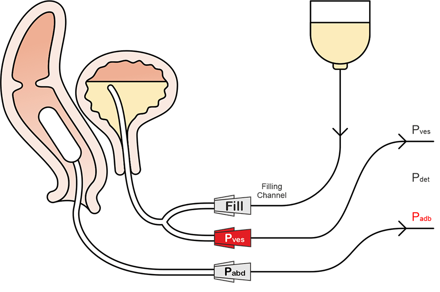 Urodynamic Catheters for Accurate Pressure Measurement | Santron Meditronic